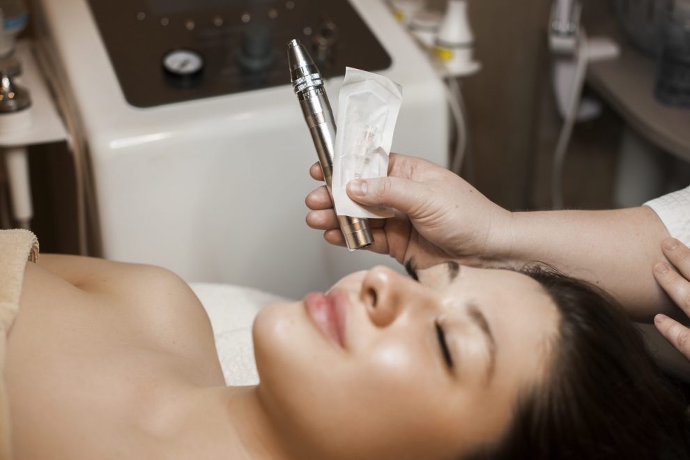 Rf Micro-needling